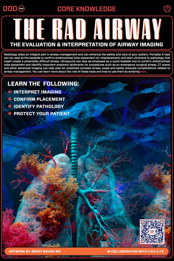 An educational poster titled 'The Rad Airway' featuring a vibrant digital illustration of lungs and airway structures intertwined with colorful coral-like formations. The poster outlines the importance of radiology in airway management and lists key learning objectives.