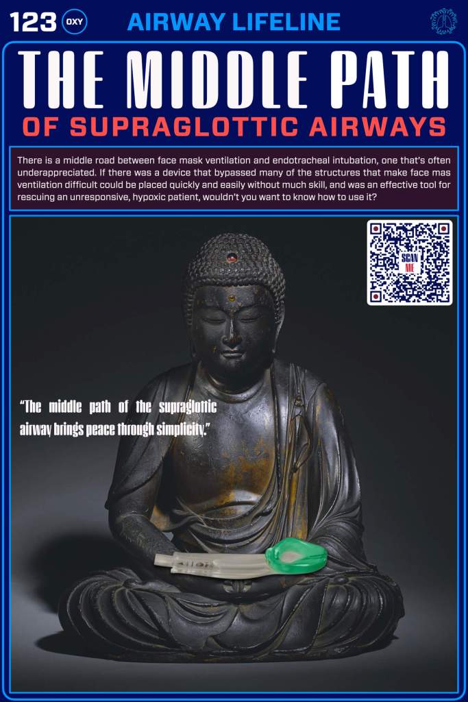 A bronze statue of a seated Buddha holding a supraglottic airway device with a green tip, accompanied by text discussing the importance of supraglottic airways for ventilation.