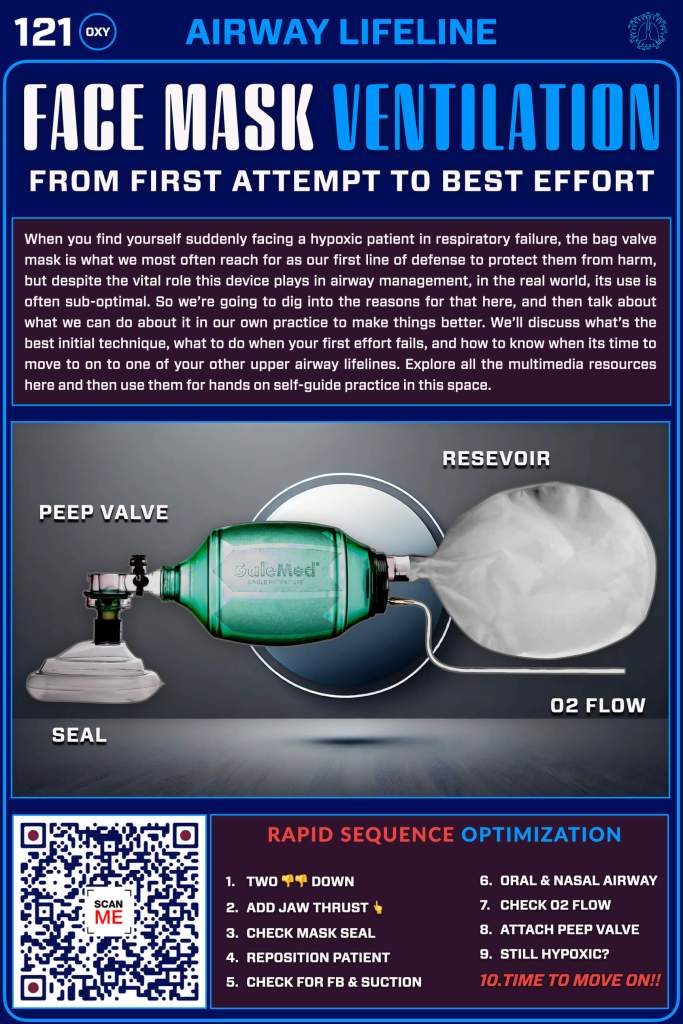 Infographic on face mask ventilation techniques, illustrating key components like reservoir, PEEP valve, and sealing methods. Includes a QR code for additional resources.