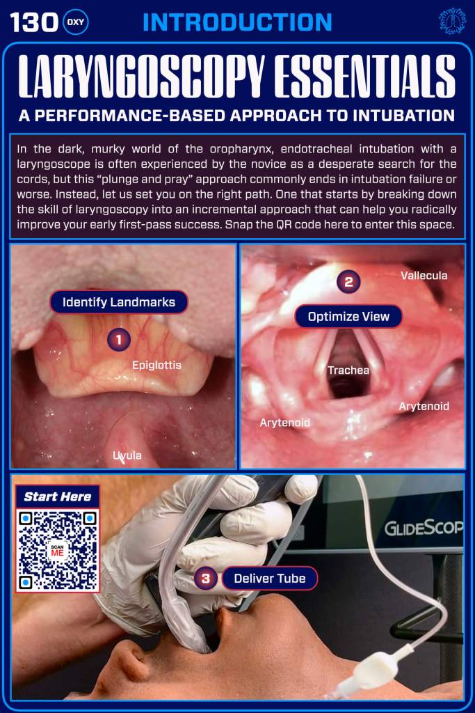 Infographic illustrating the steps for laryngoscopy during intubation, including identifying landmarks, optimizing view, and delivering the endotracheal tube.