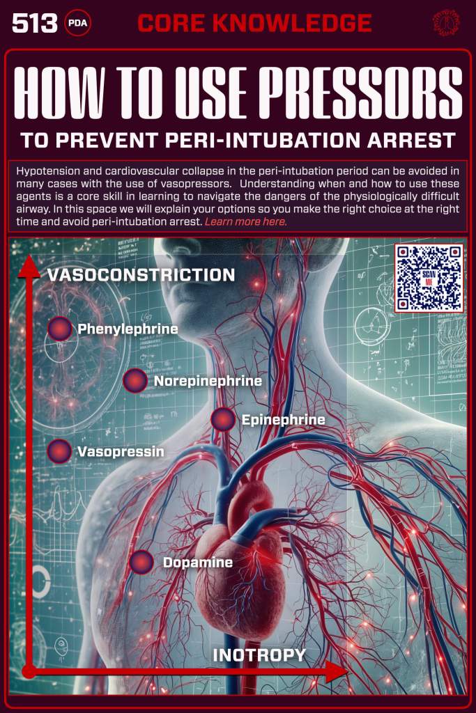 Infographic on how to use pressors to prevent peri-intubation arrest, featuring a diagram of the cardiovascular system with labels for different vasopressors including Phenylephrine, Norepinephrine, Epinephrine, Vasopressin, and Dopamine.