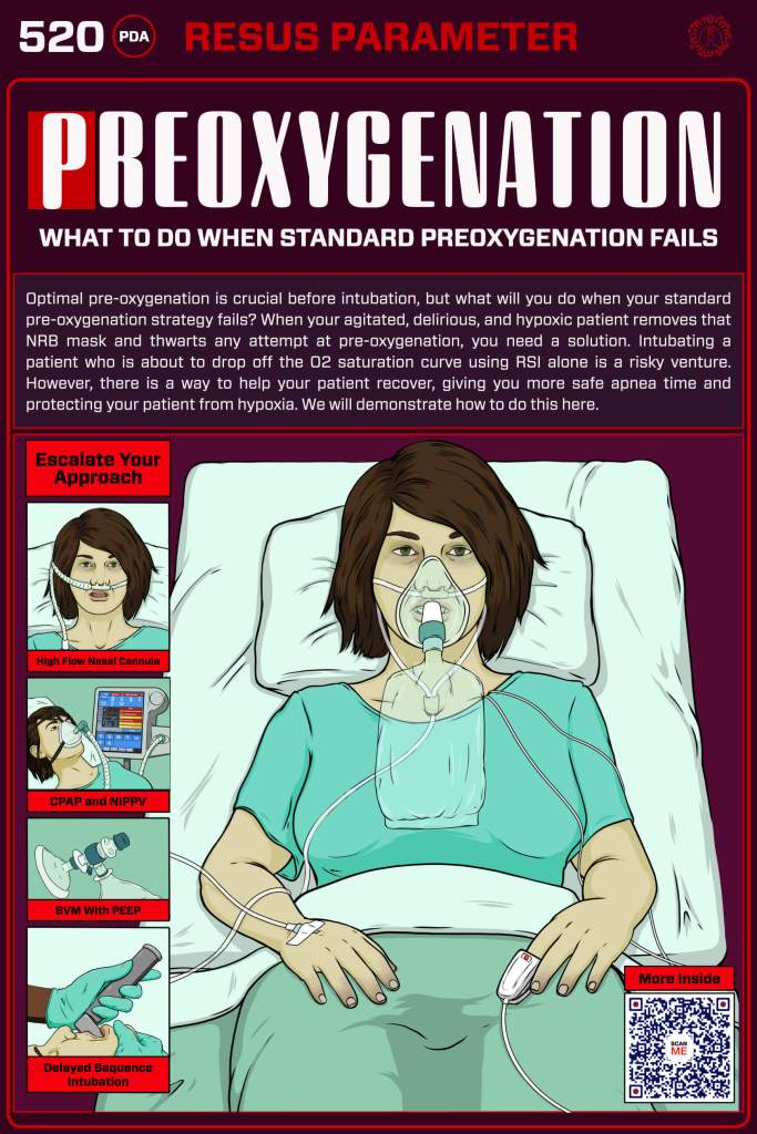 An educational poster titled 'Preoxygenation: What to Do When Standard Preoxygenation Fails,' depicting a patient in bed receiving oxygen through a face mask and nasal cannula. The poster includes illustrations and descriptions of techniques such as high flow nasal cannula, CPAP, NIPPV, bag-valve-mask with PEEP, and delayed sequence intubation.