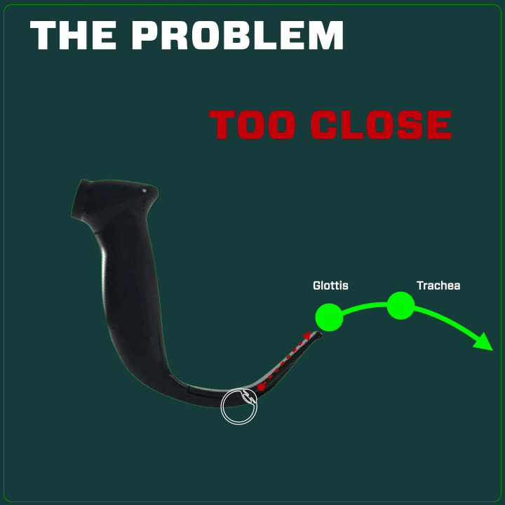 Illustration showing a tube with a label indicating the problem of being 'Too Close' between the glottis and trachea.