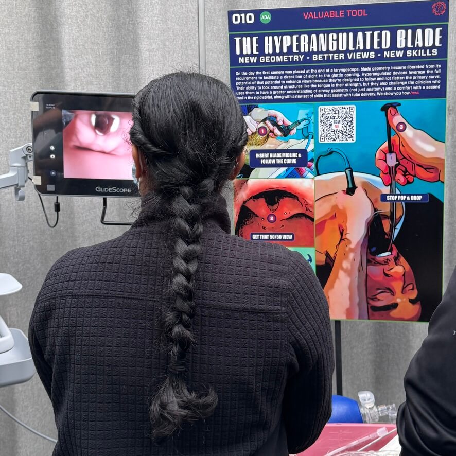 A person with braided hair is observing a demonstration of airway management techniques, with a monitor displaying an anatomical view and an educational poster titled 'The Hyperangulated Blade' highlighting new skills and geometry.