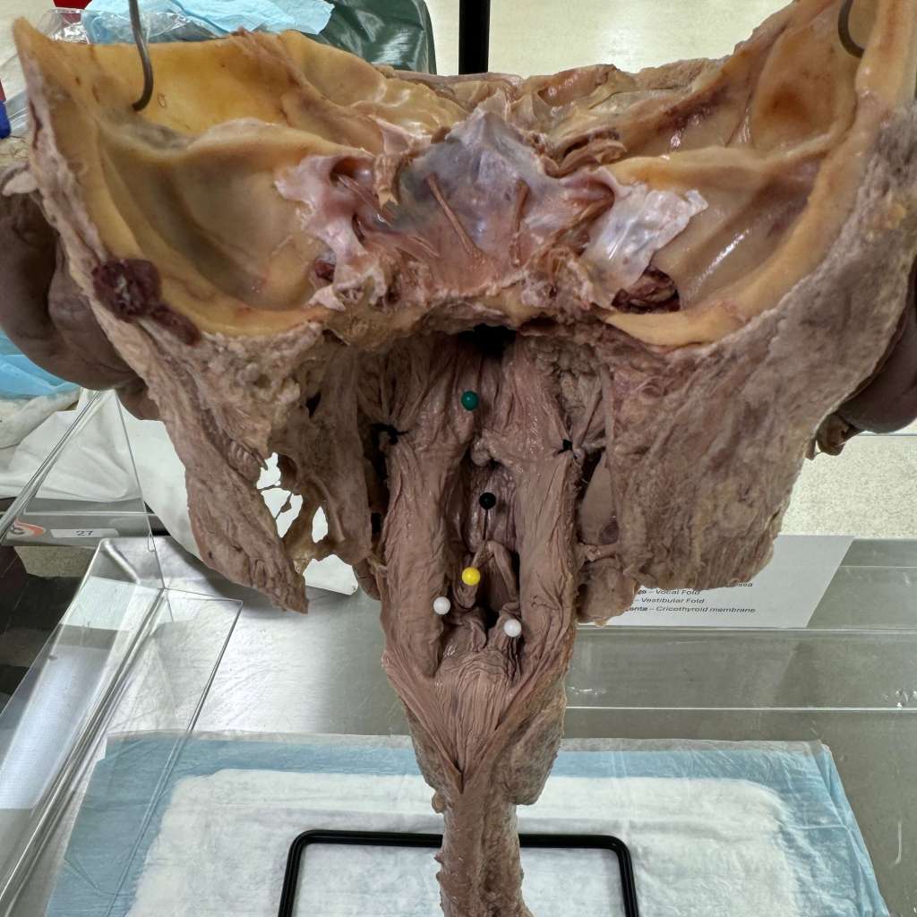 Detailed anatomical model of the airway with visible structures, including colored markers indicating key areas, displayed in a lab setting.
