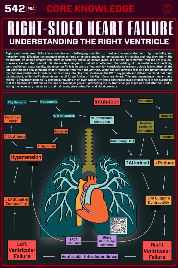 Infographic detailing right-sided heart failure and the function of the right ventricle, illustrating the interplay between the lungs and heart, and highlighting critical factors impacting patient management.