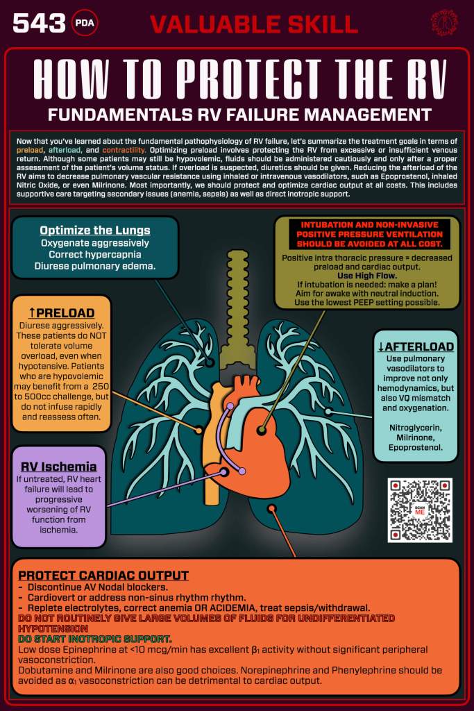 An infographic detailing the management of right ventricular failure, including treatment goals, optimizing lung function, preloading, addressing RV ischemia, and protecting cardiac output.