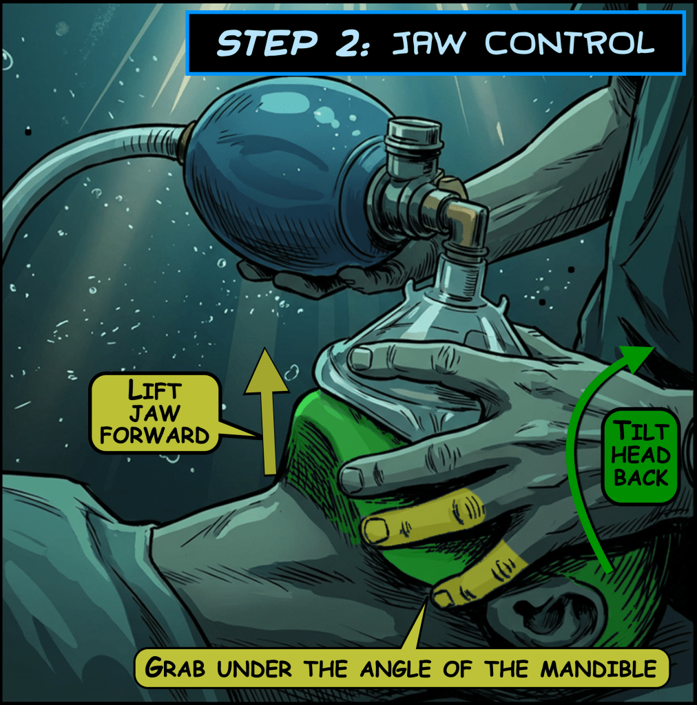 Illustration showing Step 2: Jaw Control for resuscitation, highlighting actions to lift the jaw forward, grab under the angle of the mandible, and tilt the head back. Includes arrows pointing to each action.