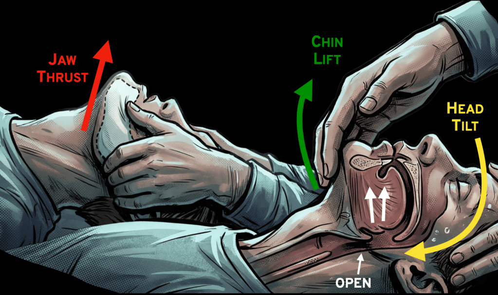 Illustration showing three techniques for airway management: Jaw thrust (red arrow), chin lift (green arrow), and head tilt (yellow arrow), demonstrating proper positioning on an unconscious individual.
